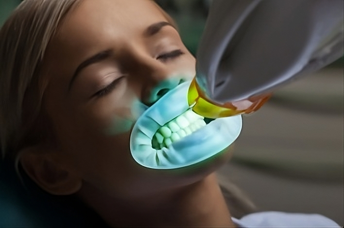 Igiene dentale